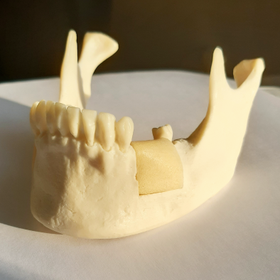 картинка Денто-модель нижней челюсти для имплантации FI-8, Medskills 