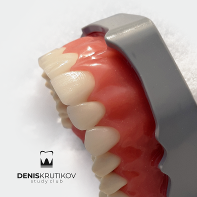картинка Денто-модель для создания прямых композитных реставраций FJ-14S (верхняя челюсть), Medskills 