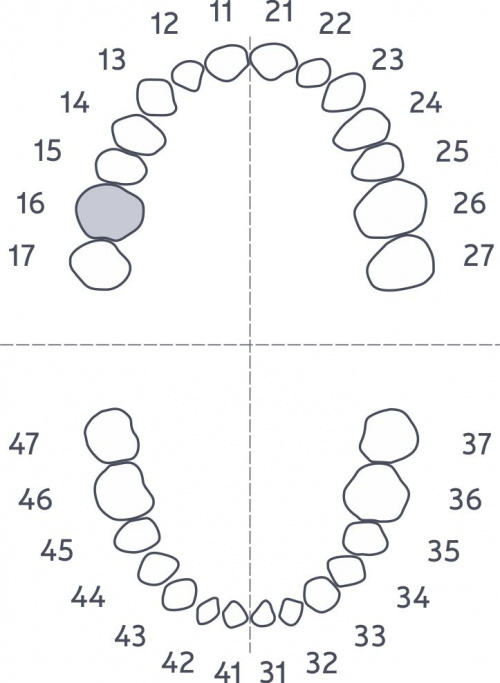 картинка Комплект из 10 зубов одного номера FT-28.10.1S, Medskills 