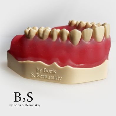 картинка Модель для одномоментной имплантации B2S, Medskills 