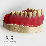 картинка Модель для одномоментной имплантации B2S, Medskills