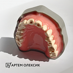 картинка Денто-модель с мягкой десной FJ-14B, Medskills