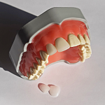 картинка Денто-модель для установки виниров  FJ-14V, Medskills